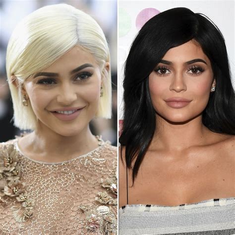 Kylie Jenner's Smile Makes Her Unrecognizable — Plus More Stars
