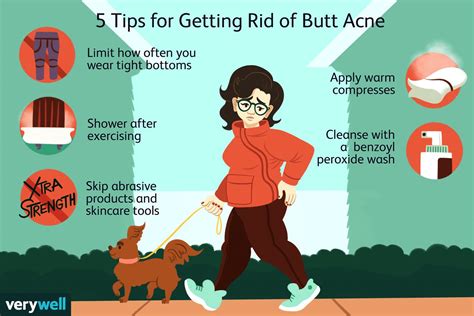 Butt Acne: How to Get Rid of Pimples on Your Butt