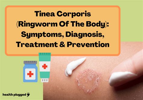 Tinea Corporis (Ringworm Of The Body): Signs, Treatments & Prevention