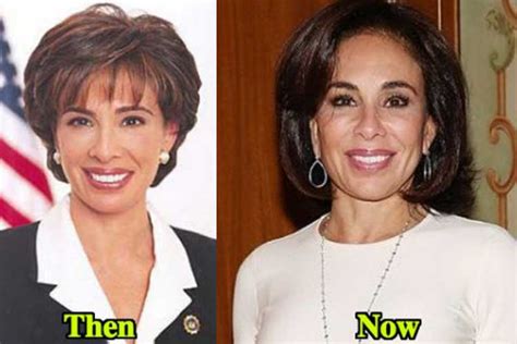 Jeanine Pirro Plastic Surgery: Botox, Facelift, Cheek Fillers, Lip Fillers