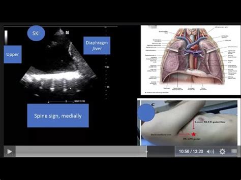 Simple step by step approach to diagnose almost all causes of acute ...