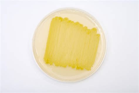 Micrococcus Luteus Culture Photograph by Science Stock Photography - Pixels