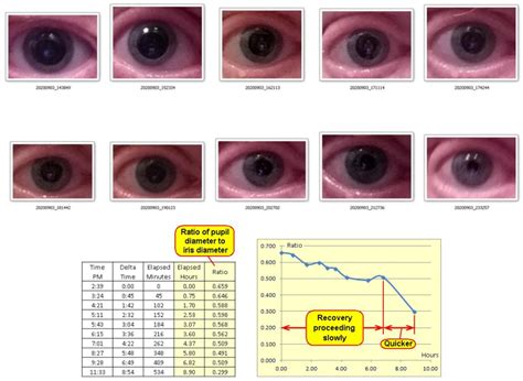 Eye Dilation - John Dunn, Consultant, Ambertec, P.E. - IEEE Consultants' Network of Long Island