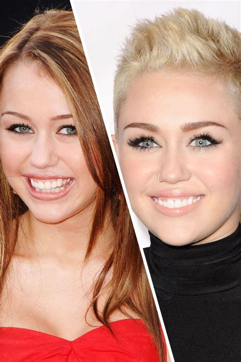 Famous Faces with Braces | Celebrities with braces, Famous faces ...