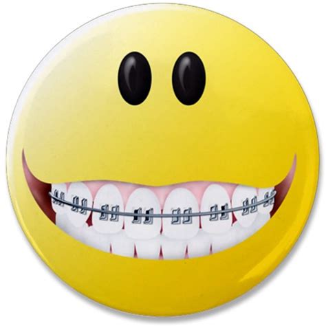 Pin by Tonia on MetAL MoUtH | Brace face, Braces, Dental fun