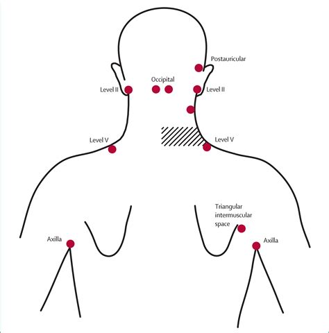 The Best 19 Occipital Lymph Nodes - greatmotherart