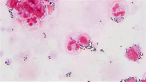 Streptococcus Gram Stain