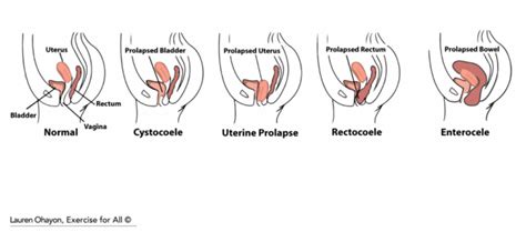 Know Your Pelvic Floor - LaurenOhayon.com