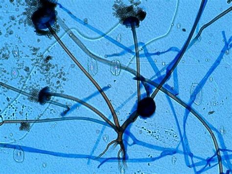 Rhizopus | Microscopic cells, Plant pathology, Microbiology