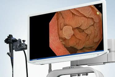 New Olympus Endoscopy System Set to Debut Late Fall