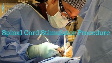 Spinal Cord Stimulator Procedure - What You Need To Know - Nebraska ...