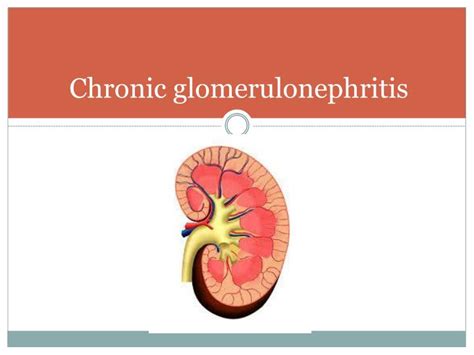 PPT - Introduction to nephrology Acute and chronic glomerulonephritis PowerPoint Presentation ...