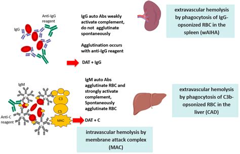 Pathogenic mechanisms of red blood cell (RBC) destruction. | Download ...