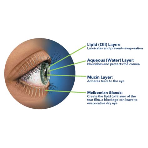 Dry Eye Disease - Redmond Eye Clinic