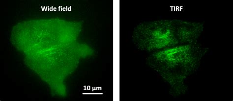 Total Internal Reflection Fluorescence Microscopy | Research Core ...