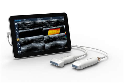 Vascular Access – Handheld POC Ultrasound System