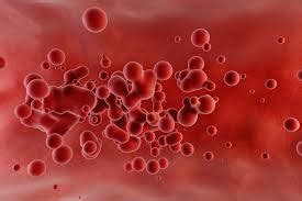 Hemoglobinopathies