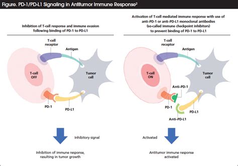 Rationale For Pd L1 Expression As A Biomarker In Immuno | Free Download Nude Photo Gallery