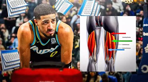 Tyrese Haliburton injury: How long it takes for NBA players to return ...