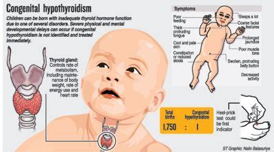 Pin on MD - pediatrics