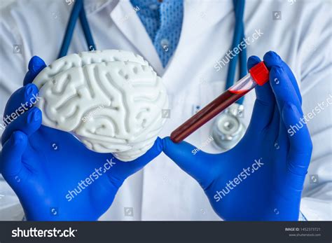 218 Prion disease Images, Stock Photos & Vectors | Shutterstock