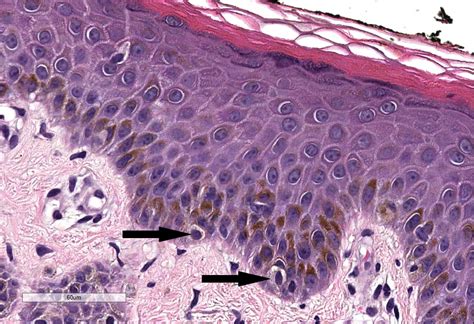 Pathology Outlines - Histology