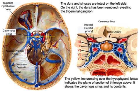 cavernous sinus Skull Anatomy, Eye Anatomy, Dental Anatomy, Gross ...