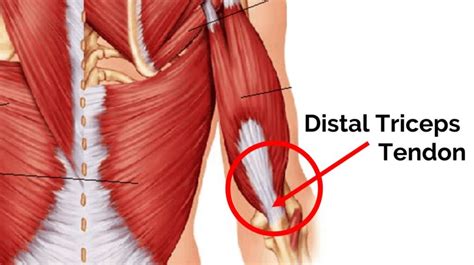 Triceps Tendon Insertion