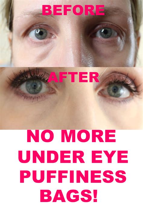 HOW TO GET RID OF UNDER EYE PUFFINESS AND BAGS! - ANNE P MAKEUP AND MORE in 2021 | Under eye ...