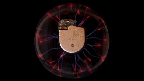 New Data Explore Risk of Magnetic Interference With Implantable Devices ...