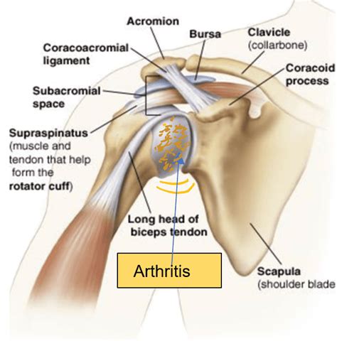 Causes and Treatment of Shoulder Pain - Medical Care 1 Urgent Care