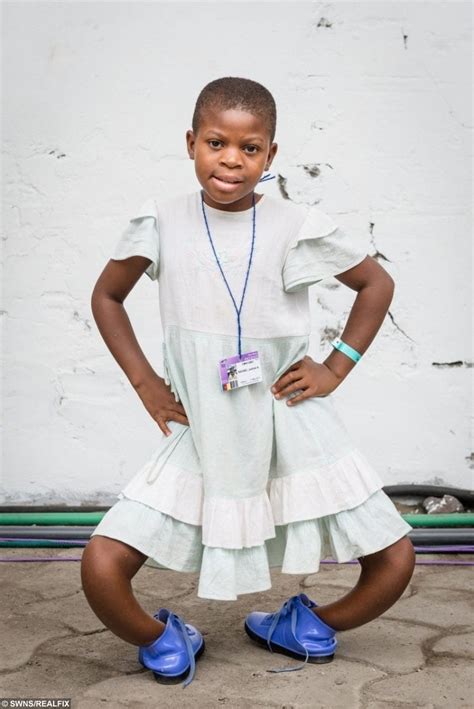 Incredible surgical transformation of 11-year-old girl whose bowed legs ...