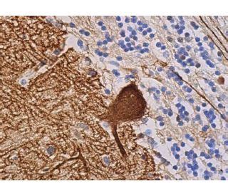 Calbindin D28K Antibody (D-4) - Immunohistochemistry - Image 363390