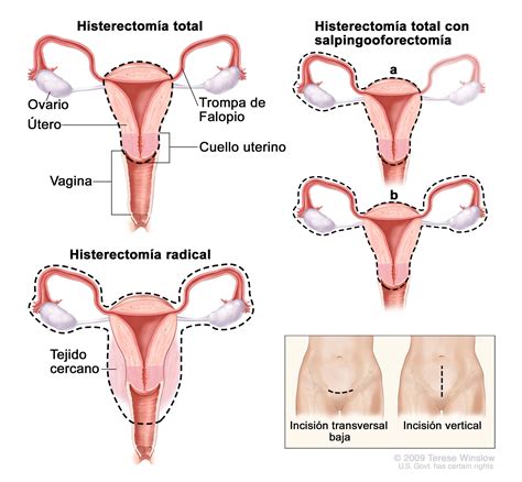 poco Permitirse Rugido cuanto pesa el utero y los ovarios Adiós recibo ...