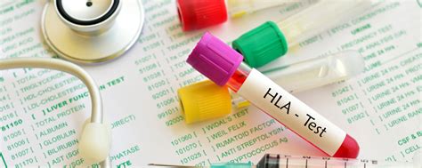 What is HLA test? | Lyfboat