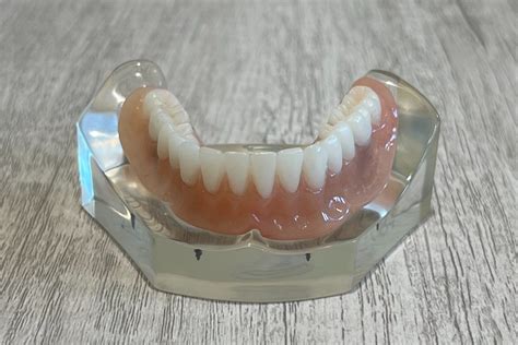 Snap-In Dentures Birmingham, AL - Alabama Snap-In Dentures