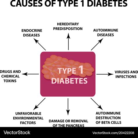 Causes diabetes type 1 infographics Royalty Free Vector