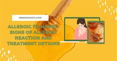 Allergic to Honey: Signs of Allergic Reaction and Treatment Options – B ...