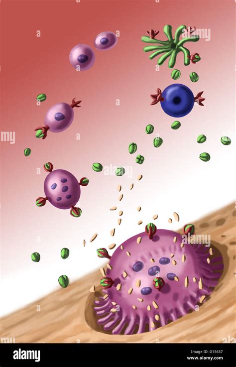 Illustration showing bone resorption; osteoclasts (pink) are breaking ...