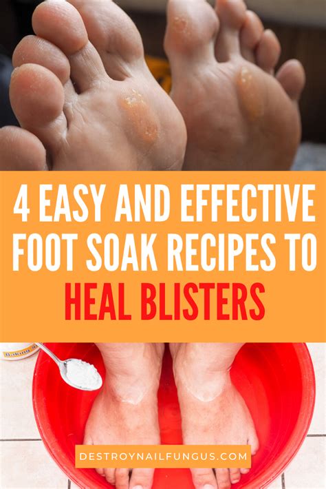 Foot Soak For Blisters: 4 Soothing And Effective DIY Recipes