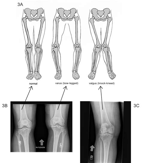 Knee - QuickPhys