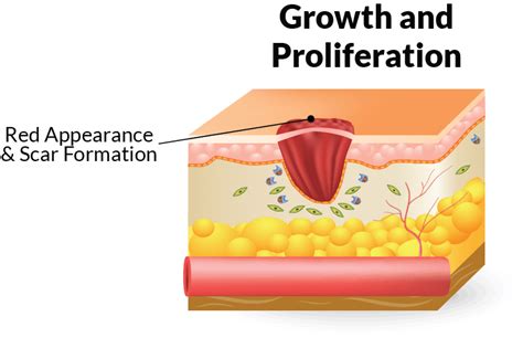 The Four Stages of Wound Healing and How to Treat Them—Home Care Delivered