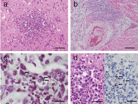 Figure 1 from Systemic Streptococcus dysgalactiae Subspecies equisimilis Infection in a ...