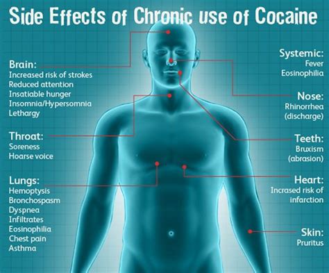 Ibogaine Treatment Cocaine | Crack Cocaine - Baja Ibogaine Center