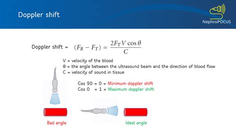 Basics of Doppler Ultrasound for the Nephrologist: Part 1 - Renal Fellow Network