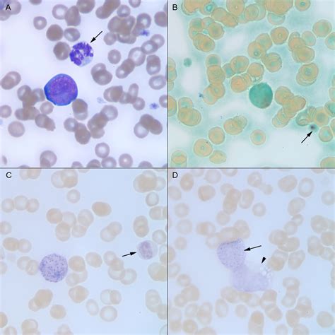 Cytochemical staining of blood in a dog with acute myelomonocytic leukemia | eClinpath