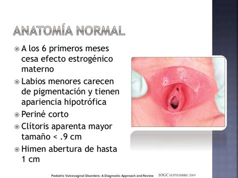 Candidiasis, vulvovaginitis pediátrica y cervicitis