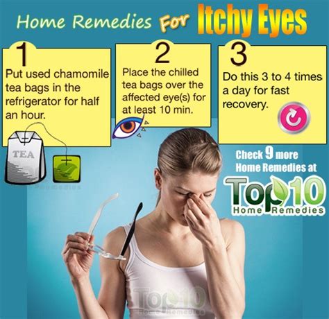 Home Remedies for Itchy Eyes | Top 10 Home Remedies