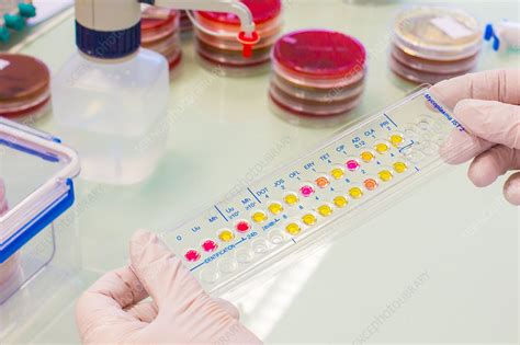 Mycoplasma test - Stock Image - C034/3991 - Science Photo Library