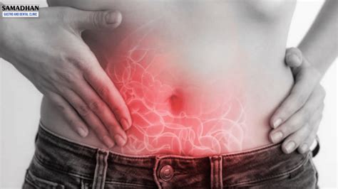 Stomach Gas:Causes, Prevention and Treatment | Samadhan Clinic